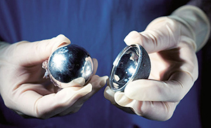 hip replacement device